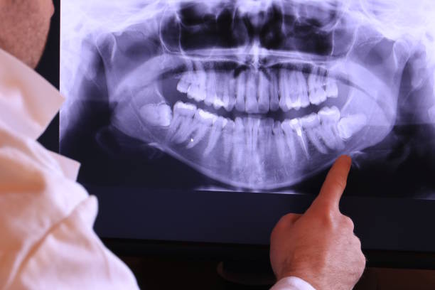 Best 24-Hour Emergency Dentist in New City, NY