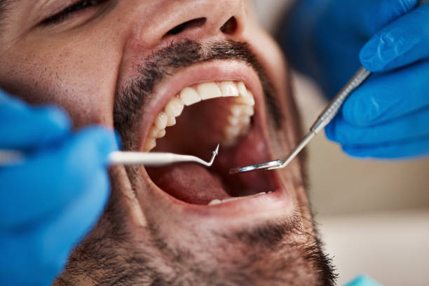 Best Urgent Dental Care for Toothache in New City, NY